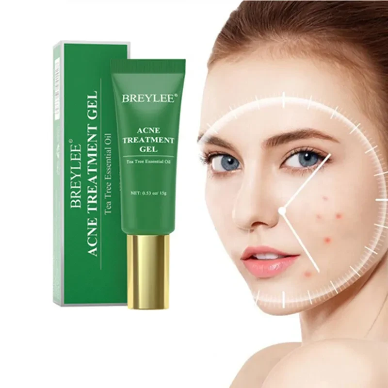 Tea Tree Acne Gel 15g Emergency Type Amazon Cross-border
