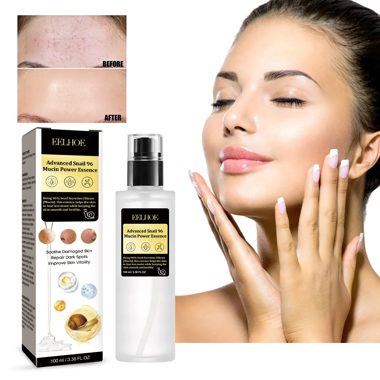 Collagen Fading Wrinkle French Acne Muscle