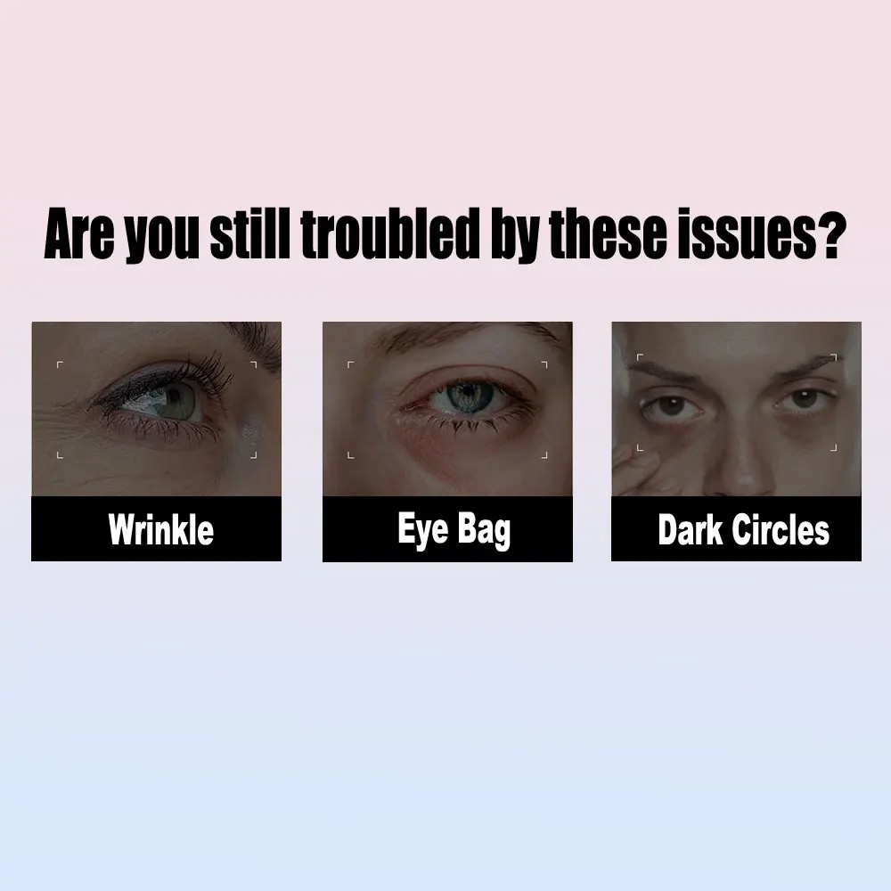 Eye Cream Remove Dark Circles Eye Bags Professional Anti-aging