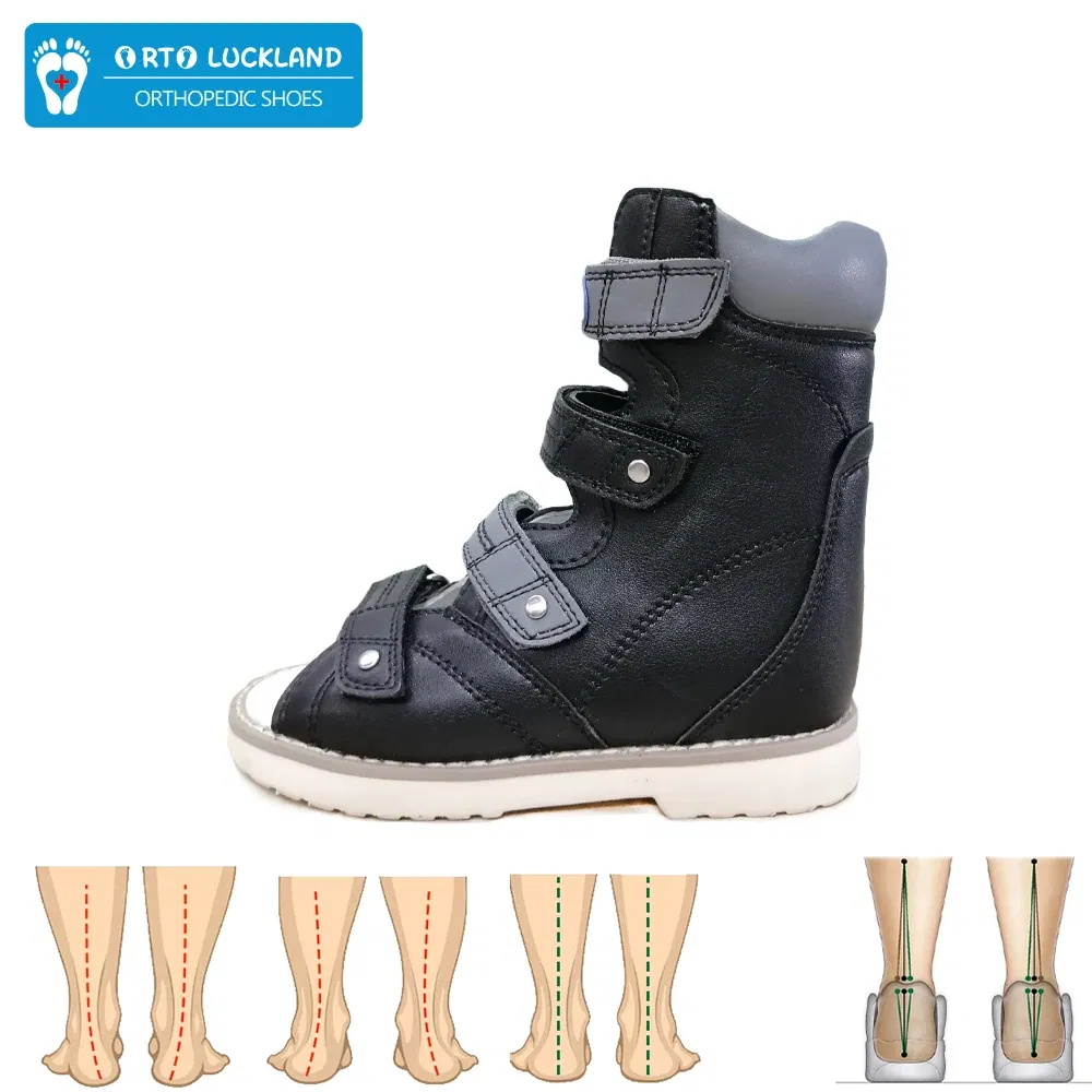 Color: WHITE, Shoe Size: 17, - Ortoluckland Toddler Boys Sandals Orthopedic Shoes For Children Casual High Top Baby Leather Clubfoot Orthotics Footwear Size20-