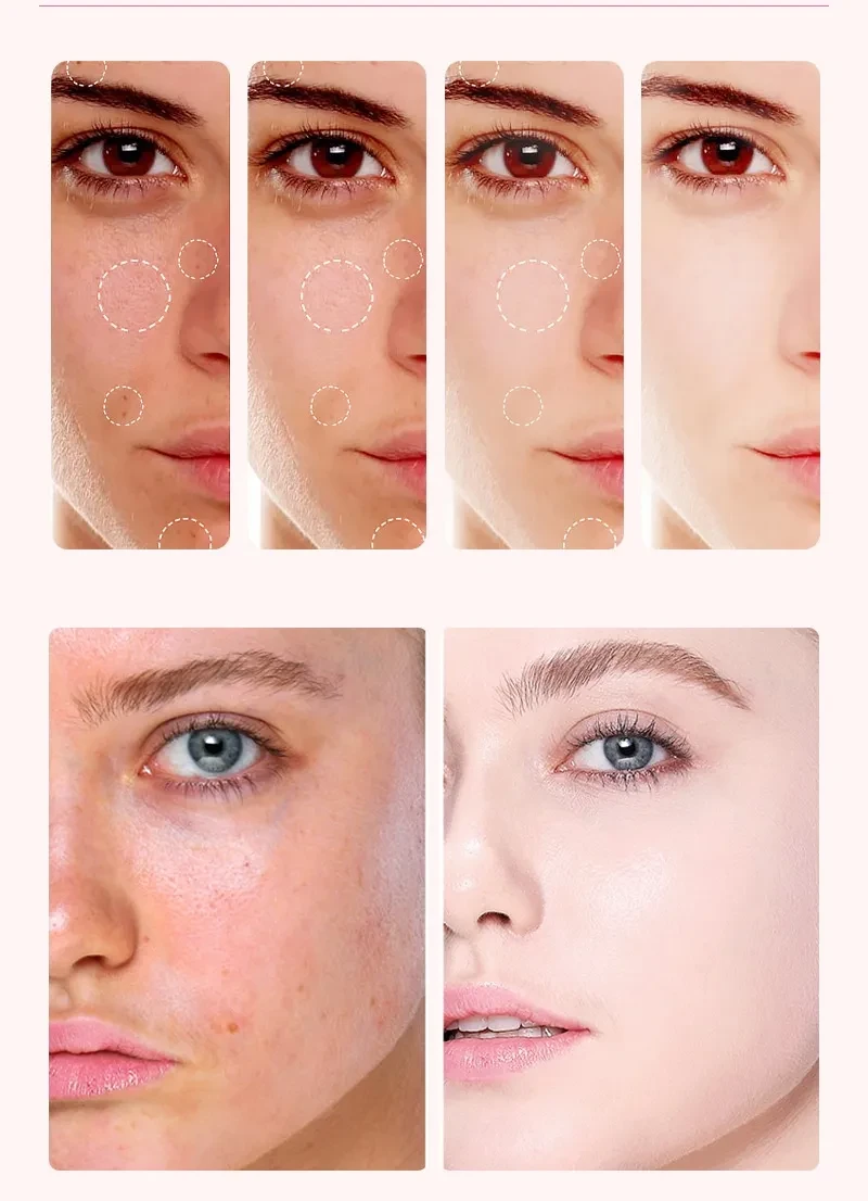 Nicotinamide Brightens Skin Tone, Fine Lines