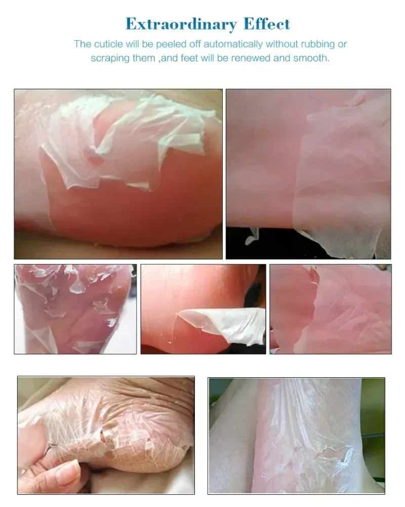 Whitening Heels Feet Peeling Anti Cracked Foot Skin Care