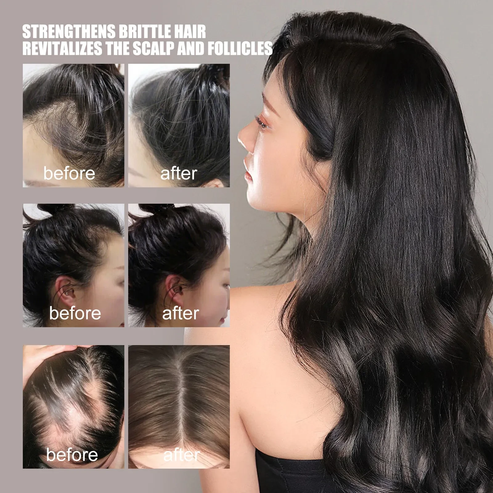 Hair Growth Serum Repair Care Essential Oil