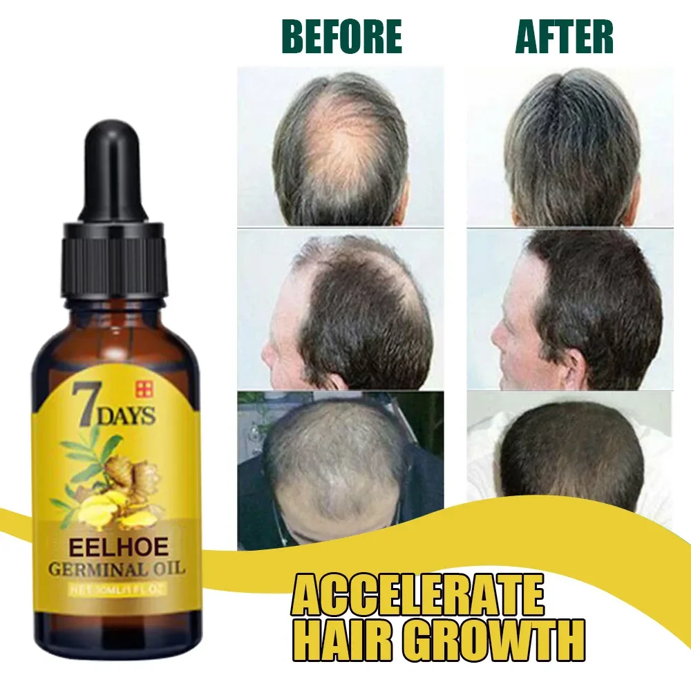 Ginger Hair Care Moisturizing Anti-drop Nutrient Solution