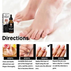 Onychomycosis Dead Skin And Repairing Lotion
