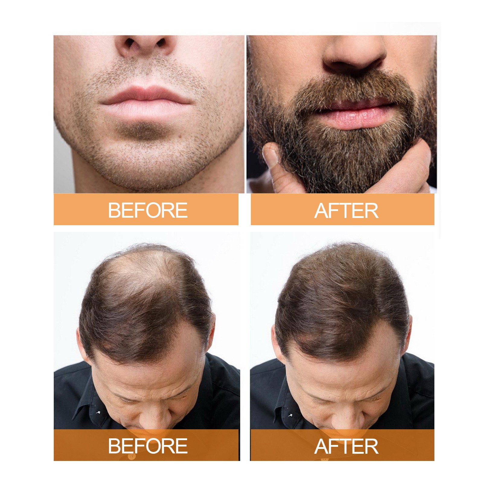 Hair Growth Serum Spray - Anti Hair Loss and Fast Growing Hair Care