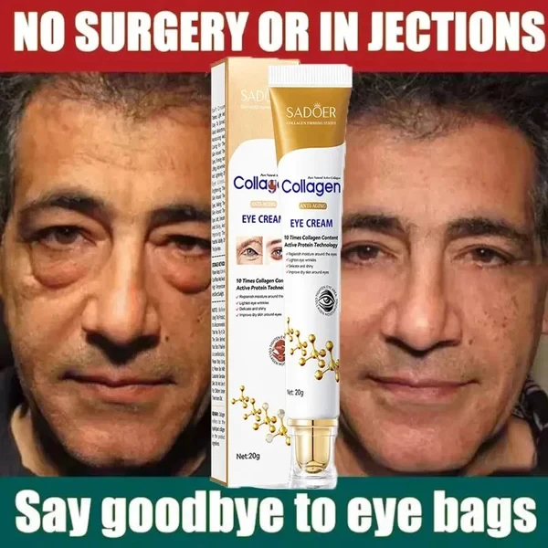 Collagen Eye Bag Removal