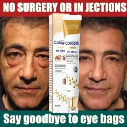 Collagen Eye Bag Removal