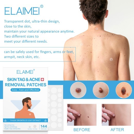 New Skin Tag Remover Patches Skin Tag Remover Pads Covers Conceals Skin Tags Mole Wart Removal Patches Fast Deliver