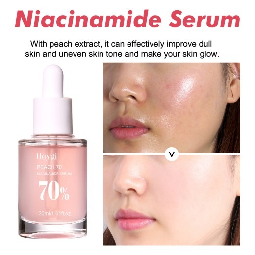 Firming And Moisturizing Pores Smallpox Diluting Softening Hydrating Toner