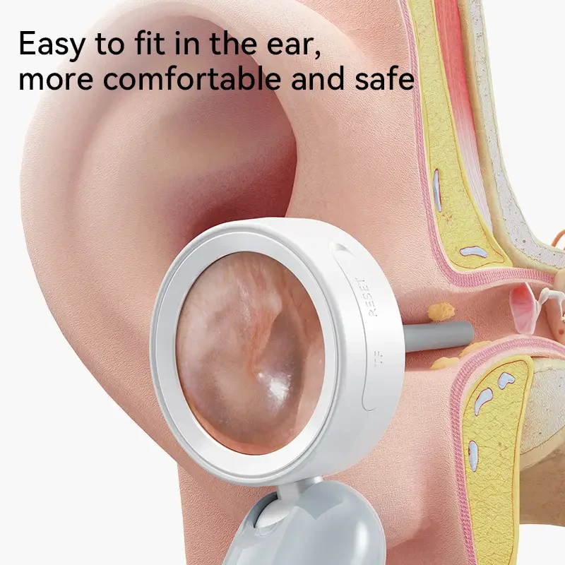 Inskam 4-in-1 Smart Ear & Nose Camera with Screen