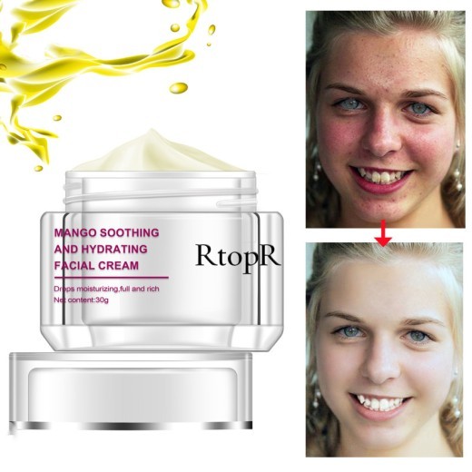 RtopR Cream RtopR001