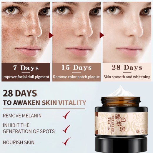 Whitening and freckle removing cream