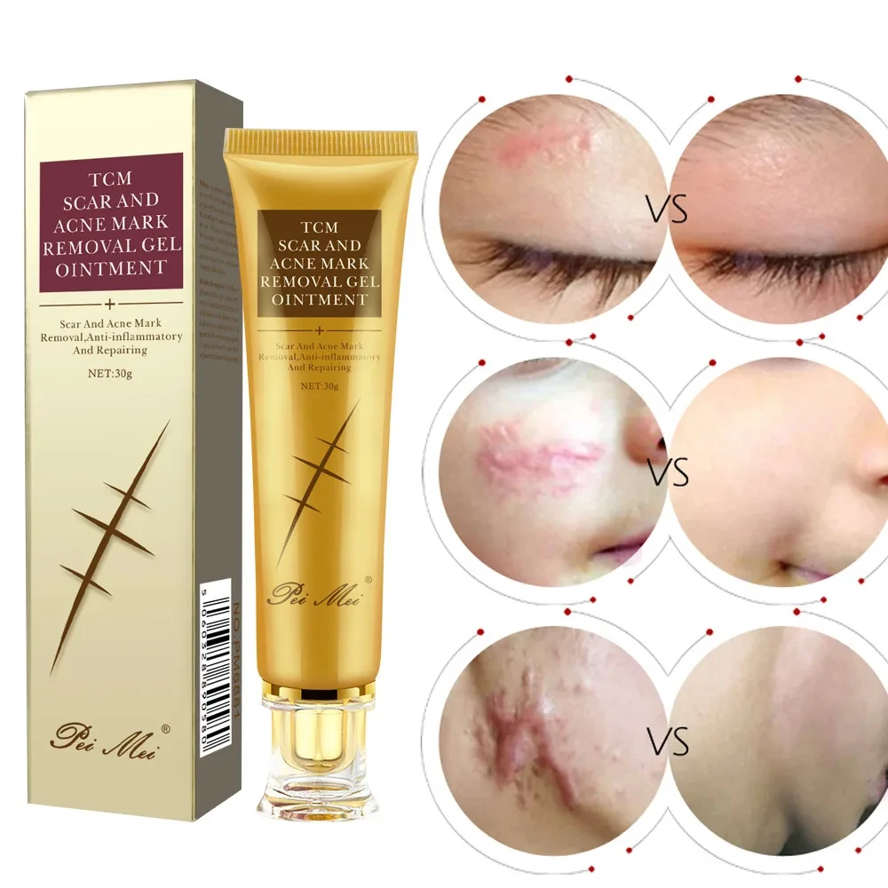 Light Scar Cream Scar Scar Gel Scar Scald Fade