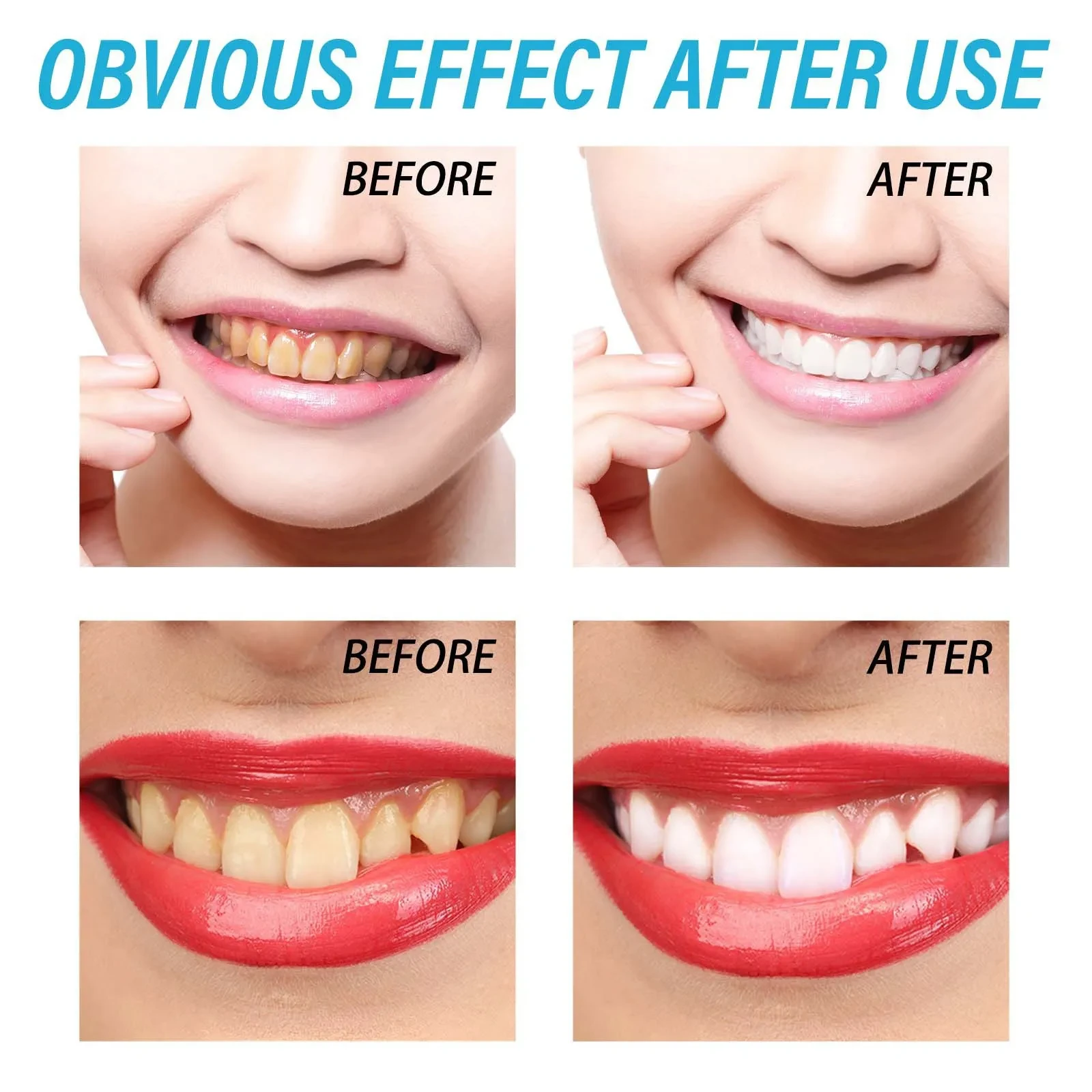 Dental stain-removing gel for gum repair in NZ. Effectively whitens teeth, removes stains, and supports healthy gums for a brighter smile