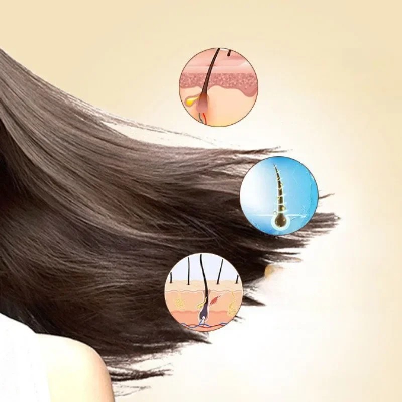 Sulfur Shampoo for Lice, Mites, Dandruff, and Itching Oil Control, Deep Cleaning, Damage Repair